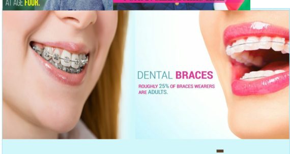 Dental Braces